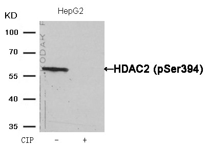 Anti-Phospho-HDAC2 (Ser394) Polyclonal Antibody