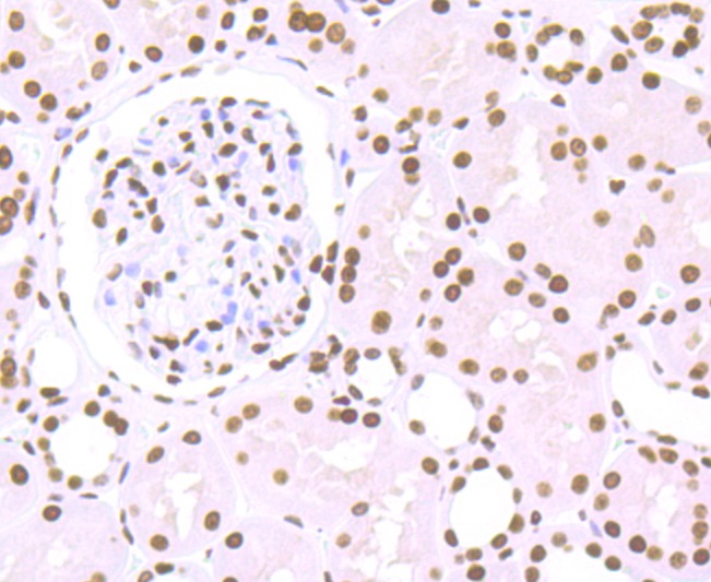 Anti-HIST1H1C Antibody (3S922)