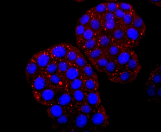 Anti-Hemoglobin subunit gamma-1/HBG1 Antibody (7L271)