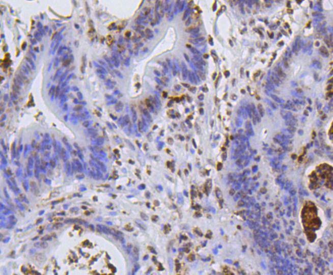 Anti-Hydroxyl-Histone H2A type 1-B/E (Tyr39) Antibody (3K640)