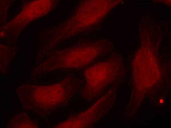 Anti-Phospho-H2AFX (Ser139) Polyclonal Antibody 2