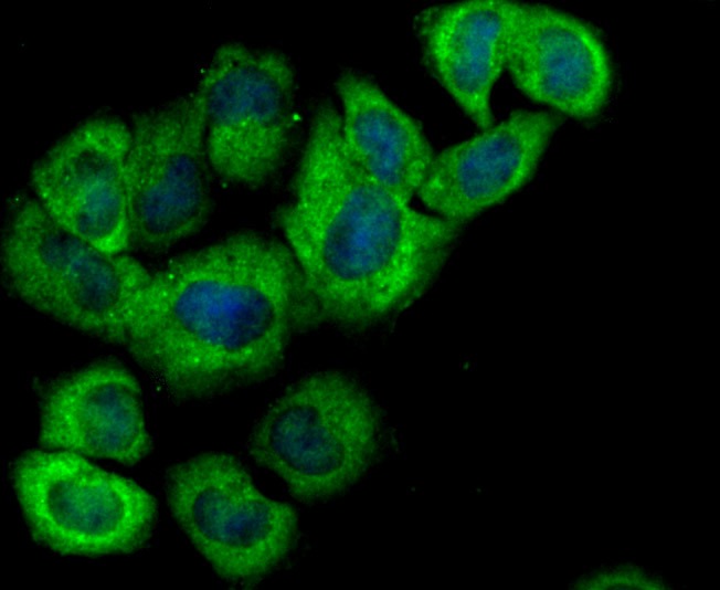 Anti-Hemopexin Antibody (2V675)