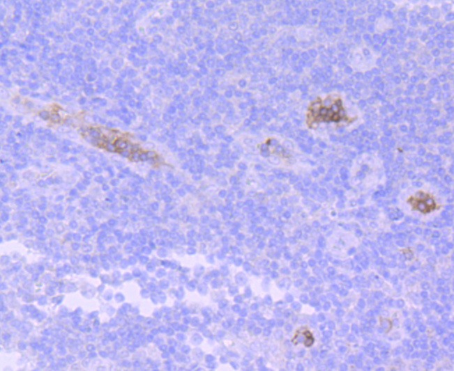 Anti-Hemoglobin subunit gamma-1/HBG1 Antibody (7L271)