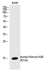 Anti-Acetyl-Histone H2B (Lys126) Polyclonal Antibody
