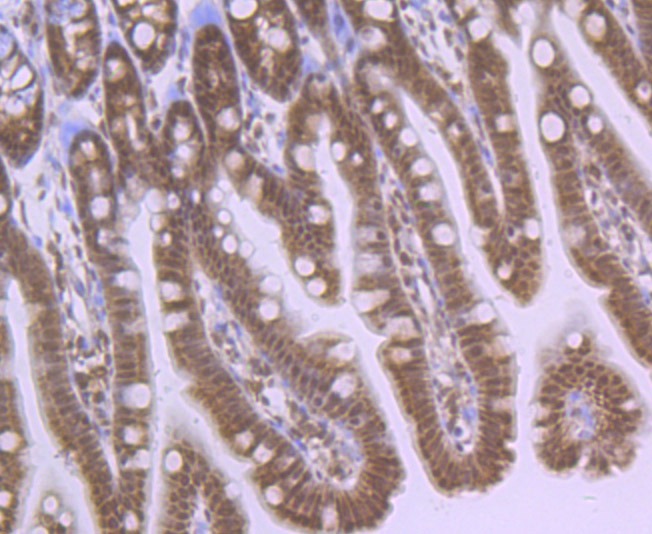 Anti-EPAS1 Antibody (7C2)