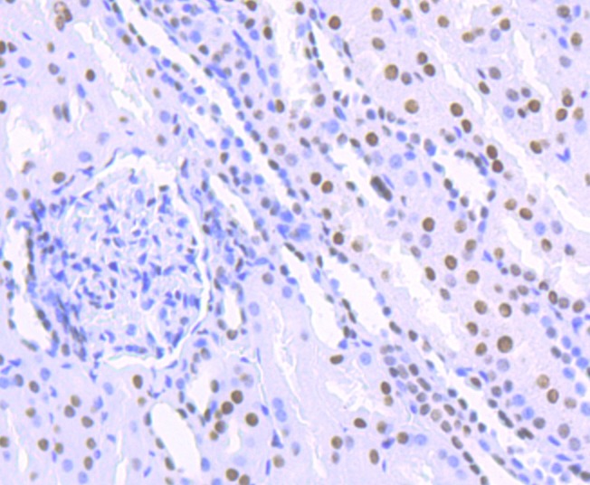 Anti-HDAC9 Antibody (3X420)