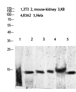 Anti-Acetyl-Histone H2B (Lys24, 25) Polyclonal Antibody