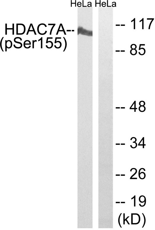 Anti-Phospho-HDAC7 (Ser155) Polyclonal Antibody