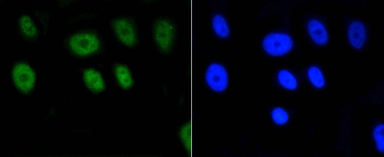 Anti-Acetyl-Histone H2A type 1-B/E (Lys9) Antibody (1M336)