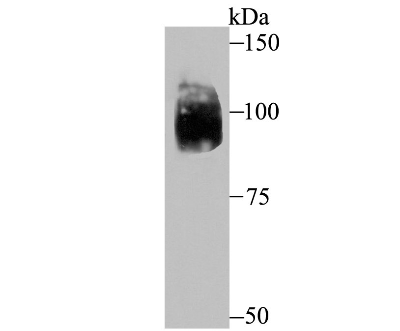 Anti-EPAS1 Antibody (7C2)
