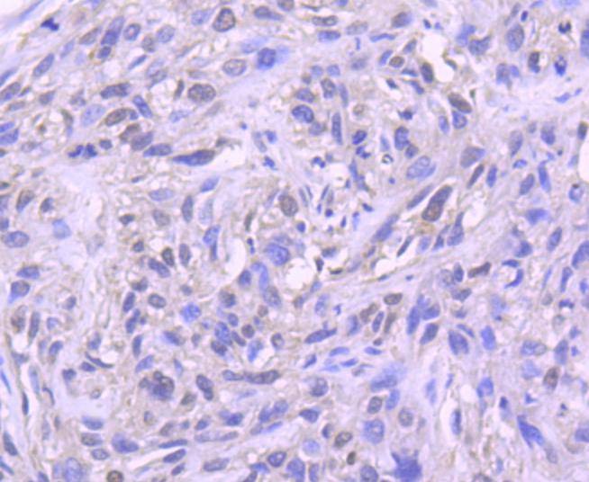 Anti-Histone H1.0 Antibody (8A133)