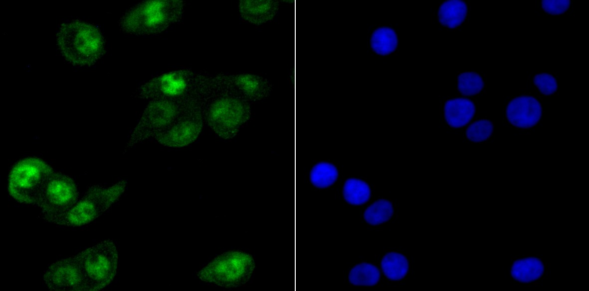 Anti-HIF1AN Antibody (9B616)