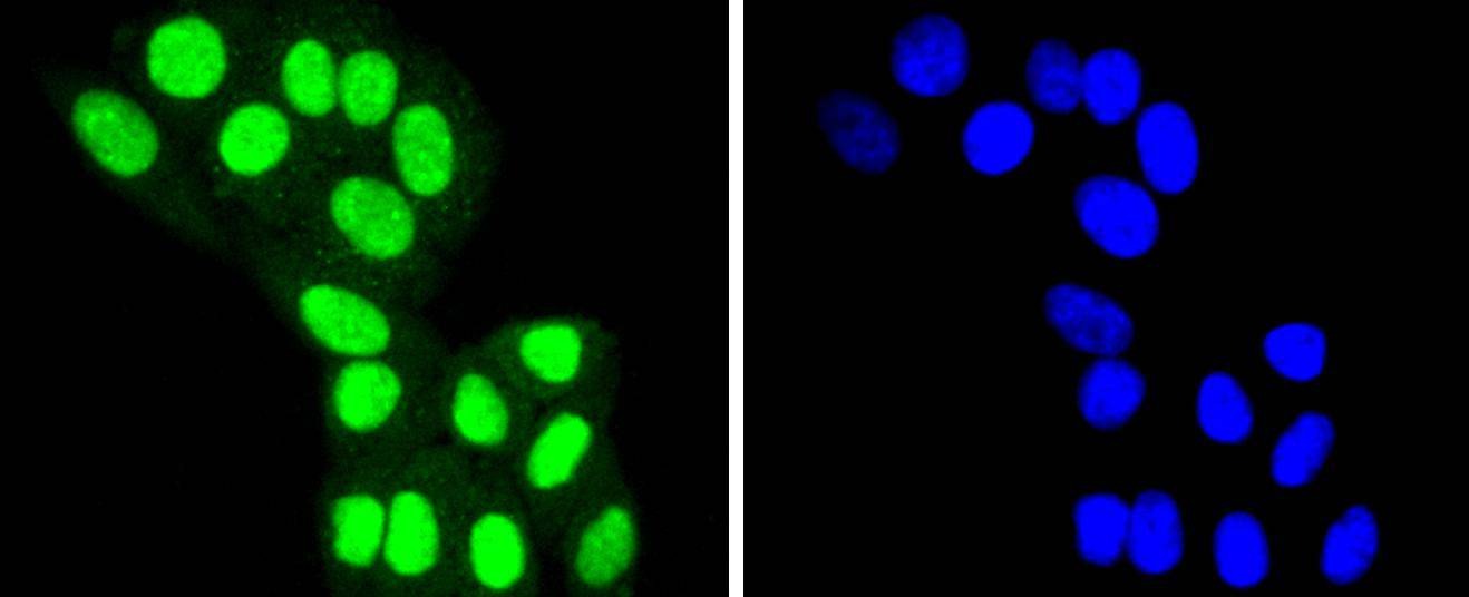 Anti-HDAC8 Antibody (6A120)