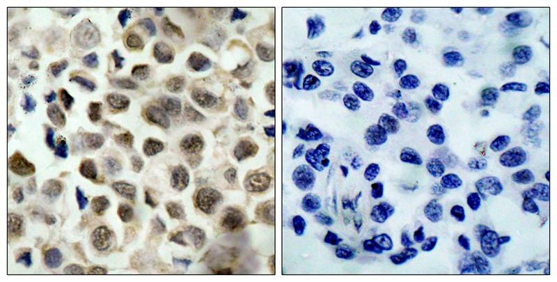 Anti-Phospho-HDAC8 (Ser39) Polyclonal Antibody