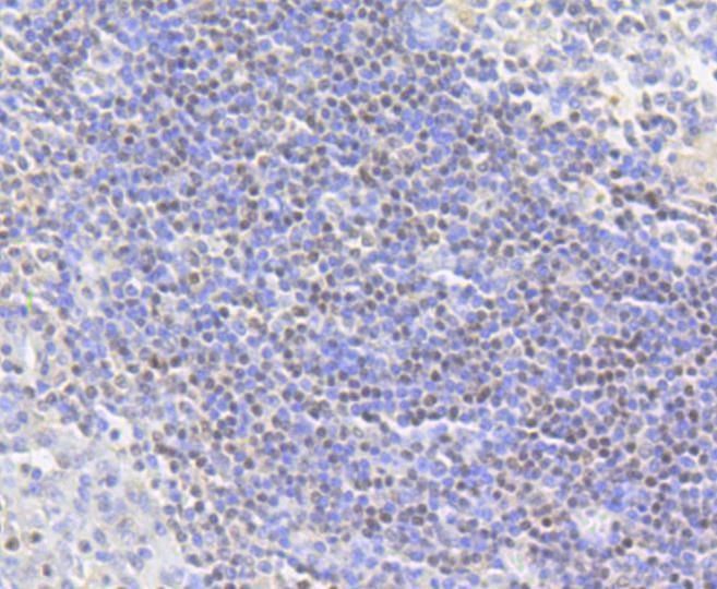 Anti-Acetyl-Histone H2A type 1-B/E (Lys9) Antibody (1M336)
