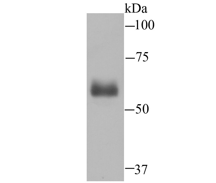 Anti-Hemopexin Antibody (2V675)