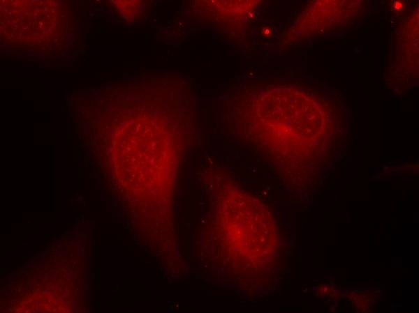 Anti-Phospho-HDAC8 (Ser39) Polyclonal Antibody