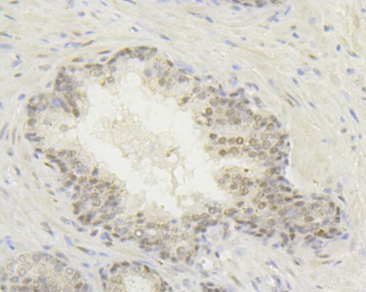 Anti-HIF1AN Antibody (9B616)