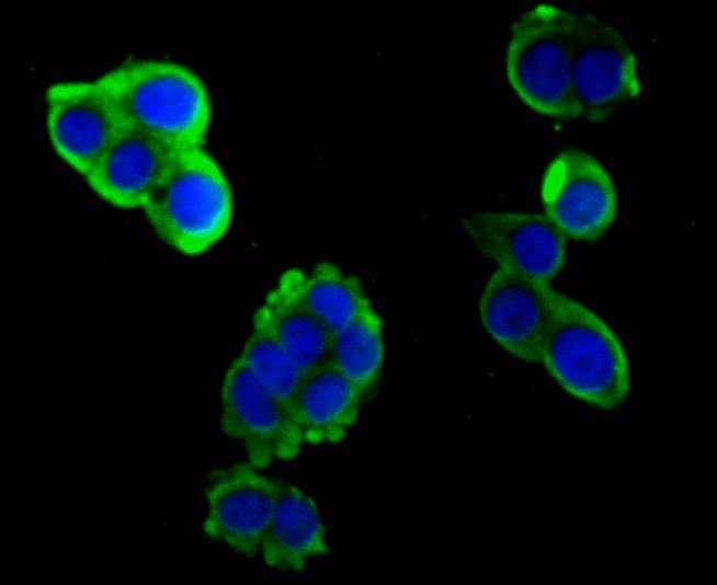 Anti-Hemopexin Antibody (2V675)