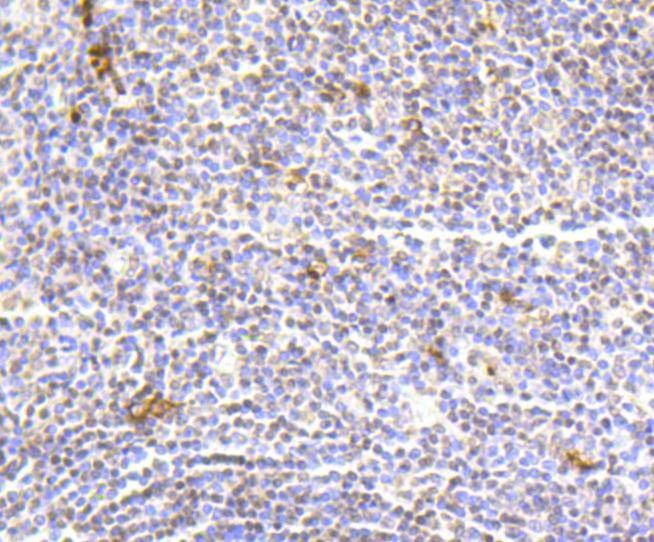 Anti-Hydroxyl-Histone H2A type 1-B/E (Tyr39) Antibody (3K640)