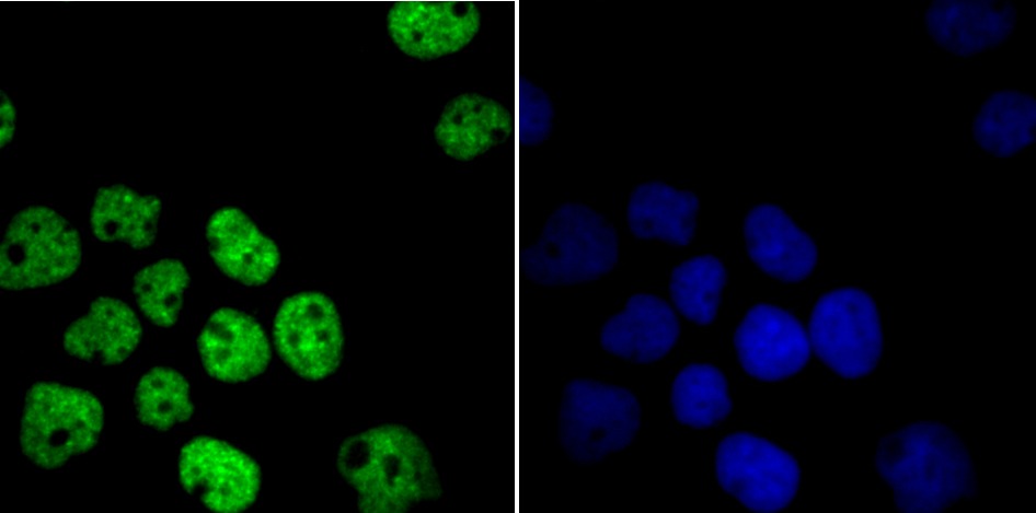 Anti-HDAC9 Antibody (3X420)