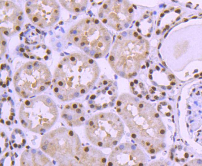Anti-HDAC8 Antibody (6A120)