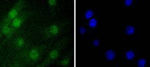 Anti-Histone H1.0 Antibody (8A133)