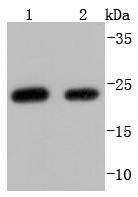 Anti-WFDC2 Antibody (4W741)