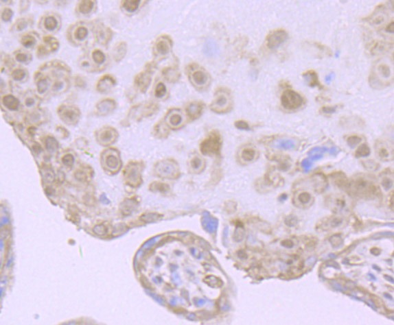 Anti-EPAS1 Antibody (7C2)