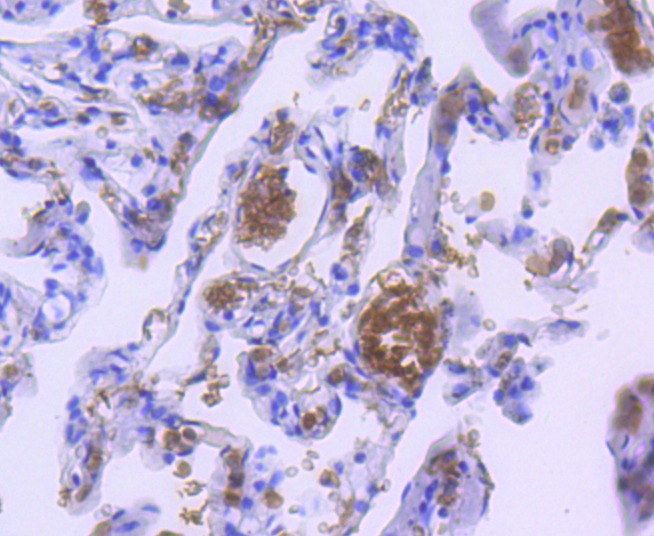 Anti-HBA1 Antibody (4N481)