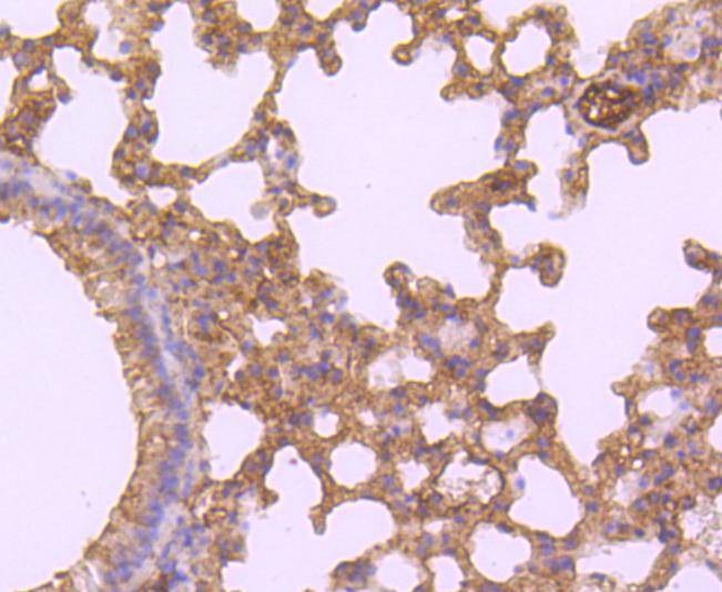 Anti-WFDC2 Antibody (4W741)