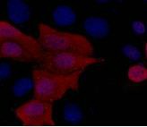 Anti-His Tag Antibody (6Y42)