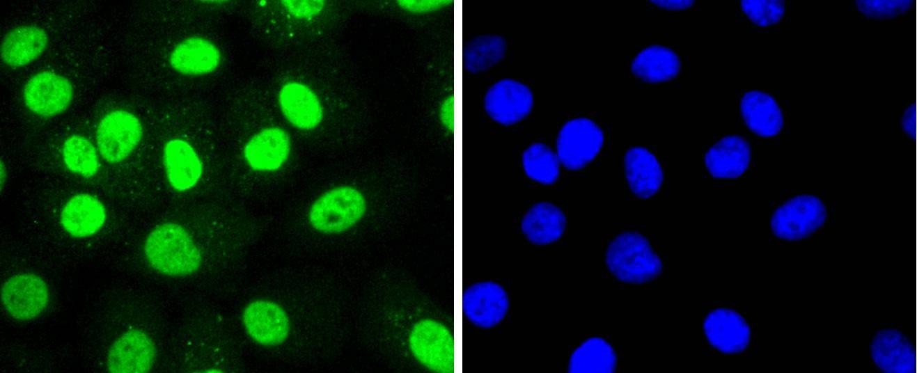Anti-HDAC8 Antibody (6A120)