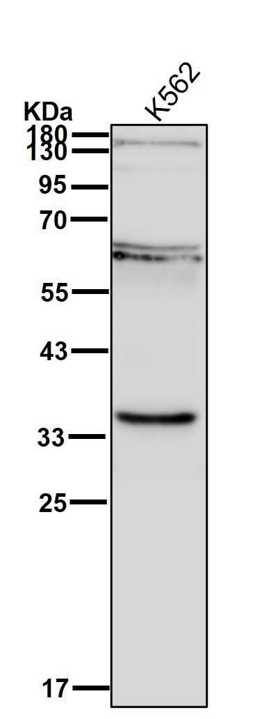 Anti-HSD11B1 Antibody (6B221)