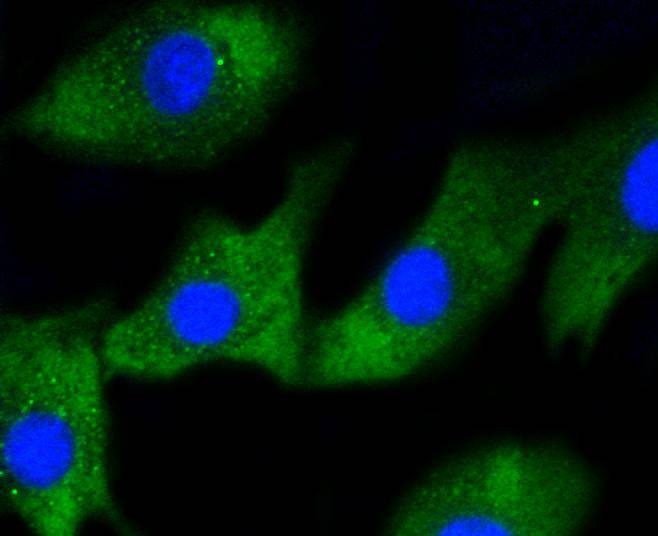 Anti-IRF1 Antibody (2Q473)