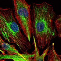 Anti-KLHL22 Antibody (5K493)