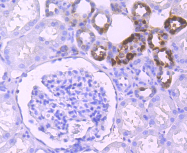 Anti-Klotho Antibody (8C828)