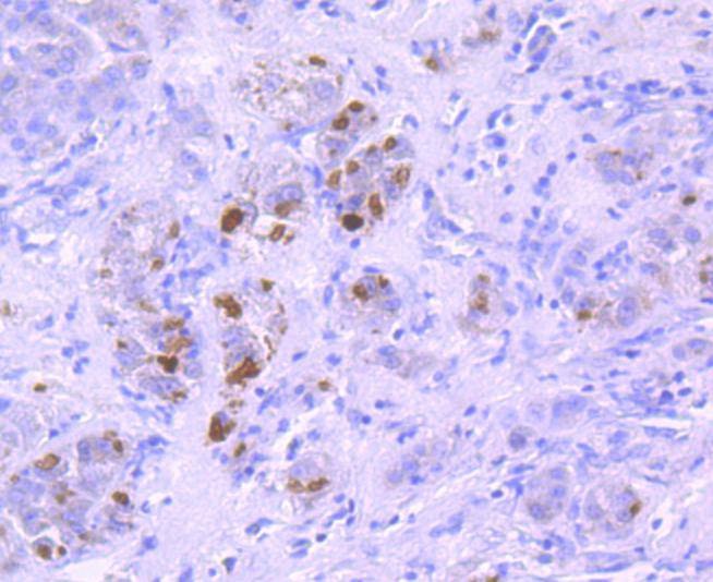 Anti-K63-linkage Specific Ubiquitin Antibody (7M837)