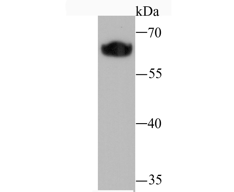 Anti-Klotho Antibody (8C828)
