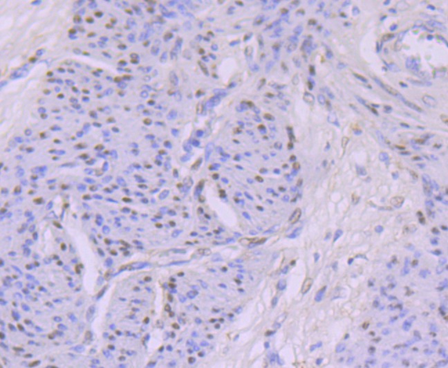 Anti-KAT8 Antibody (7Z632)