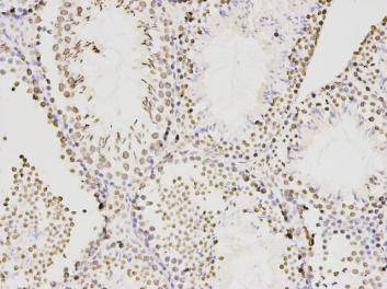 Anti-KLHDC3 Antibody (6T418)