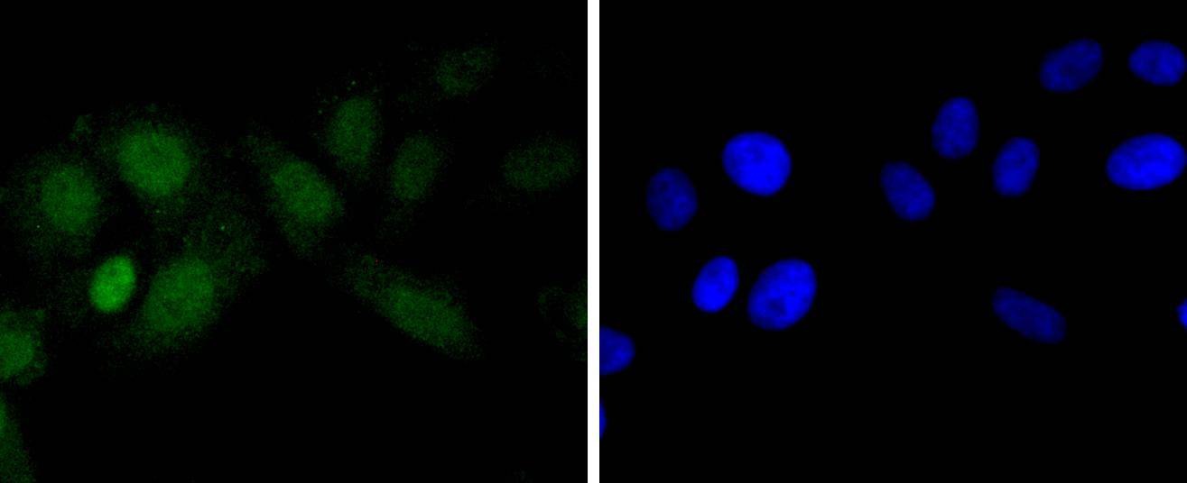 Anti-EZH2 Antibody (5A657)