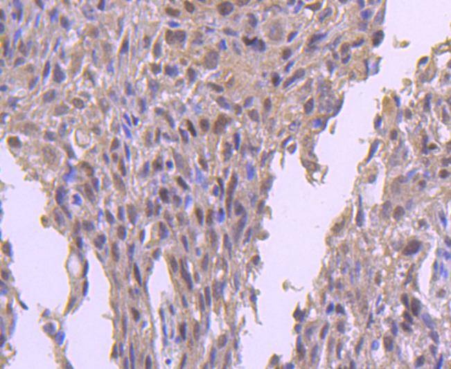 Anti-EZH2 Antibody (5A657)