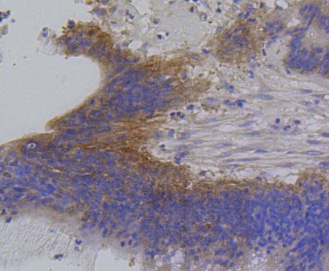 Anti-IRF1 Antibody (2Q473)