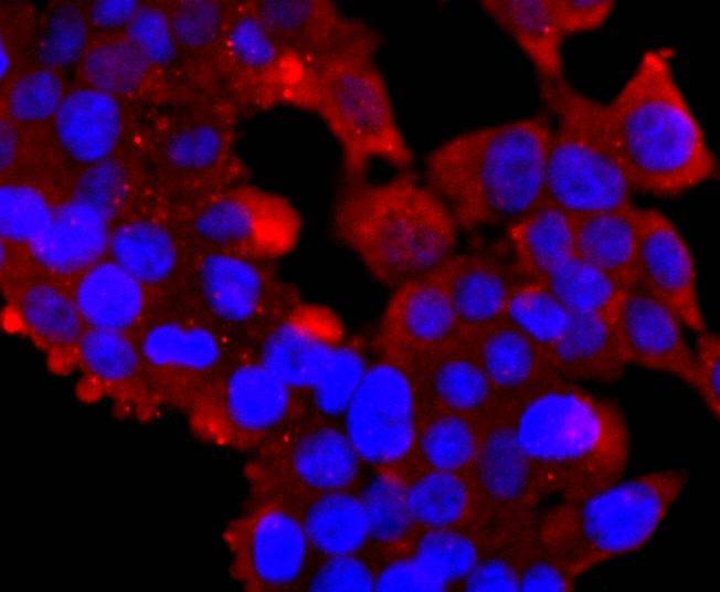Anti-K63-linkage Specific Ubiquitin Antibody (7M837)
