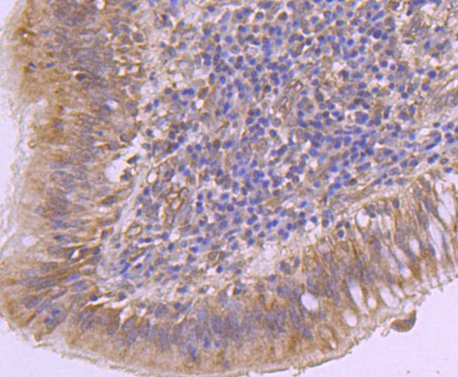 Anti-EZH2 Antibody (5A657)
