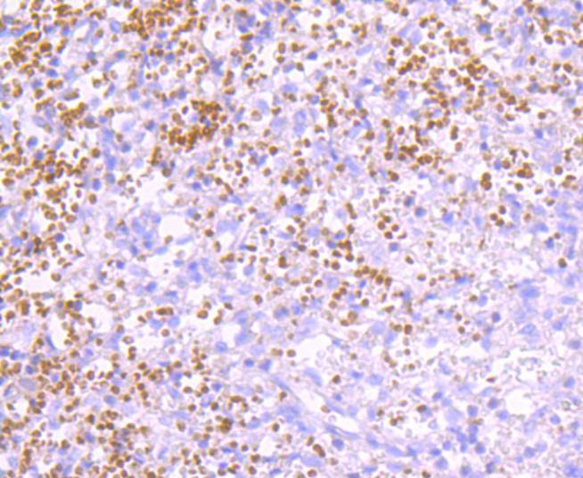 Anti-K63-linkage Specific Ubiquitin Antibody (7M837)