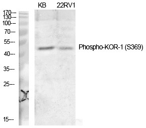 Anti-Phospho-KOR-1 (Ser369) Polyclonal Antibody