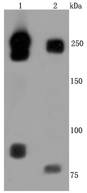 Anti-L1CAM Antibody (1P875)