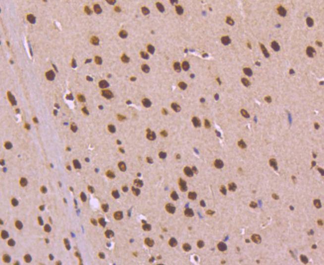 Anti-KAP1 Antibody (4I621)